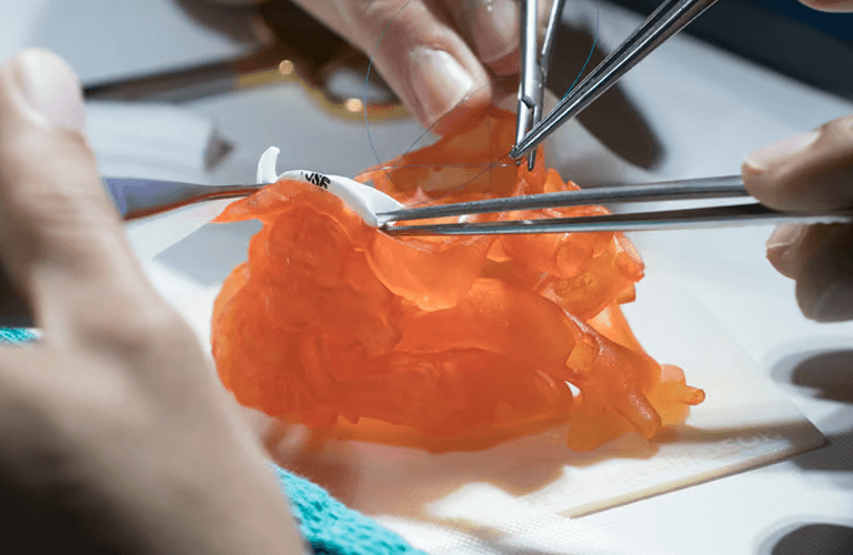 3D-printad anatomisk modell i realistiskt material – PolyJet för kirurgisk träning och simulering