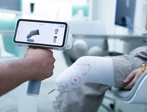 3D-skanning av amputerat ben – används för individanpassad protesdesign