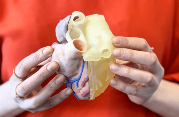 3D-printad anatomisk hjärtmodell – används för medicinsk visualisering, utbildning och kirurgisk planering