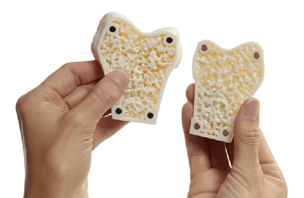 3D-printade benliknande strukturer – biomimetisk design för medicinsk forskning och implantatutveckling